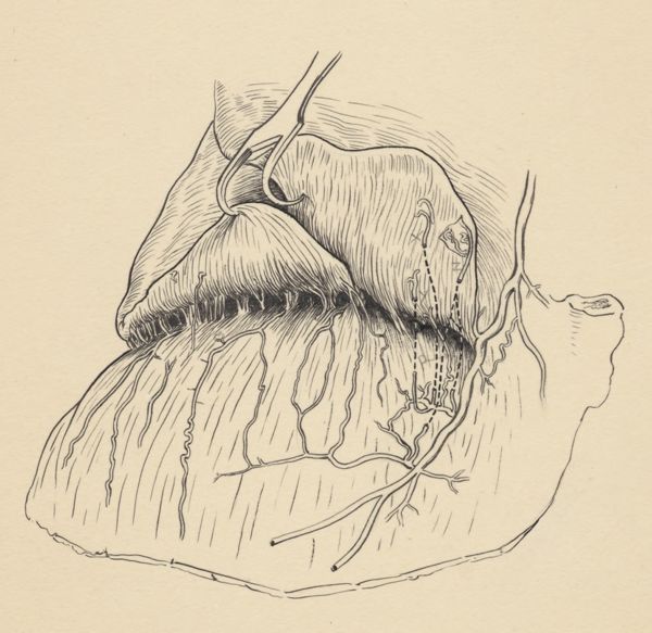 J Tinkelenberg, Part of the heart and circulatory system