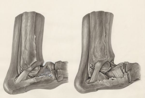 H.G Wetselaar, Muscular tissue of the foot