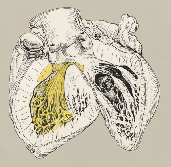 J Tinkelenberg, Heart