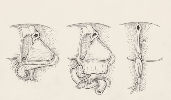 J Tinkelenberg, Tissue of the human embryo
