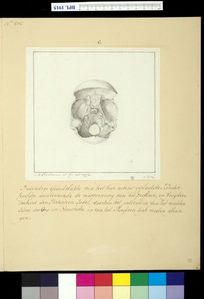 M. Houtman, Skull (interior view) of child with deformed head