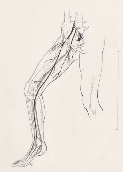 J Tinkelenberg, Tissue from the right leg and foot