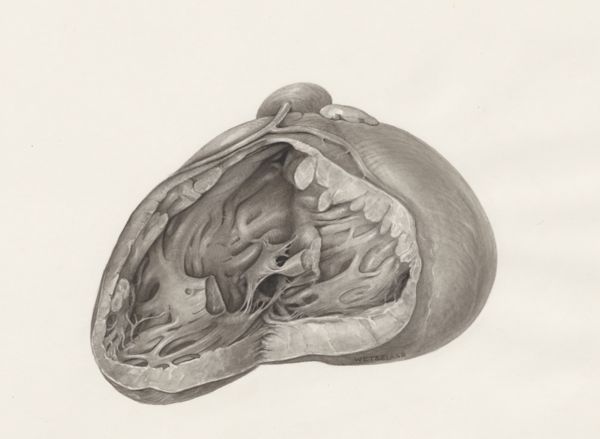 H.G Wetselaar, Cross section of a heart