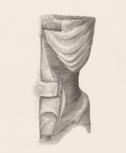J Wetselaar-Whittaker, Muscular tissue of the abdomen