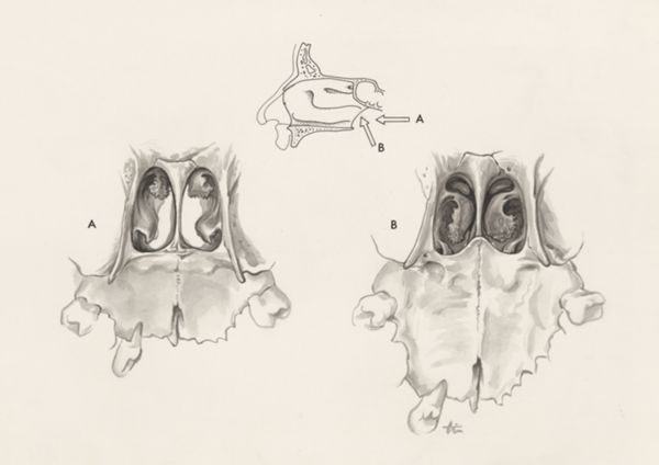 J Tinkelenberg, Respiratory system seen from below