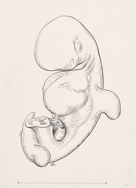 J Tinkelenberg, Human embryo