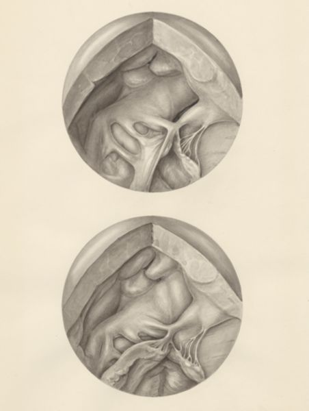 H.G Wetselaar, Two microscopic magnifications of parts of the heart