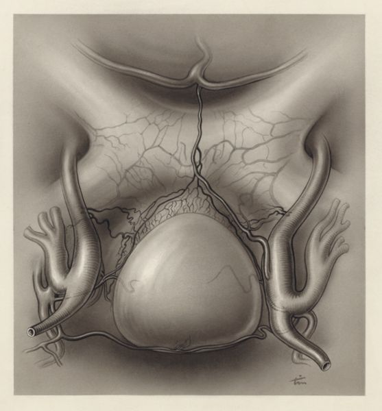 J Tinkelenberg, Circulatory system of the throat
