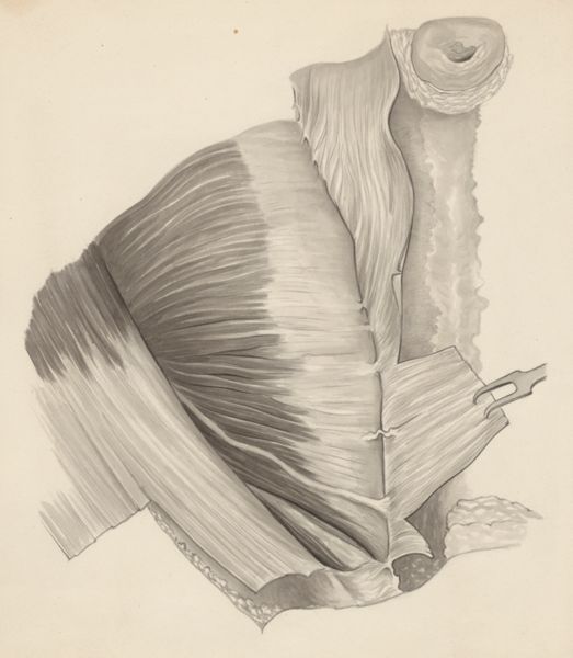 J Tinkelenberg, Tissue of the inguinal
