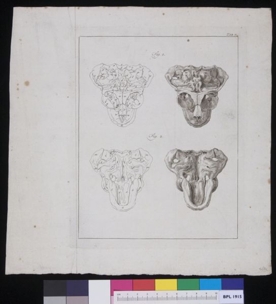 R Muys, Female pelvis