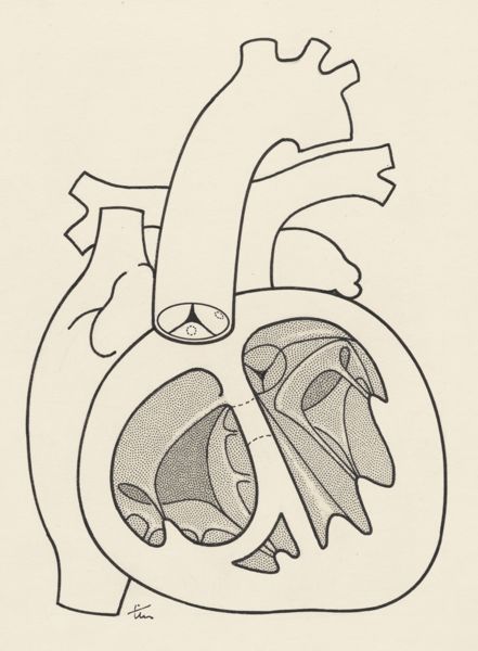 J Tinkelenberg, Schematic representation of the heart and circulatory system
