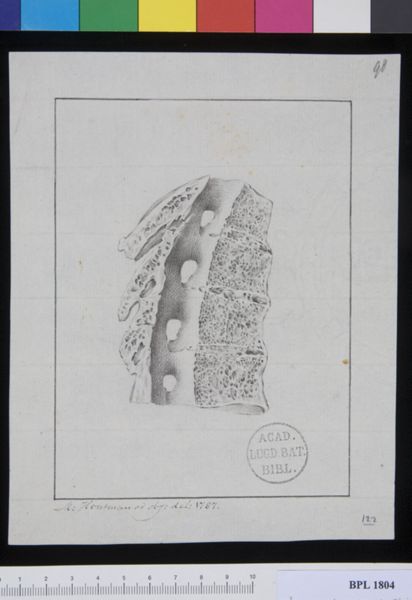 M Houtman, Pathology, fractures (Spine, cervical vertebrae)