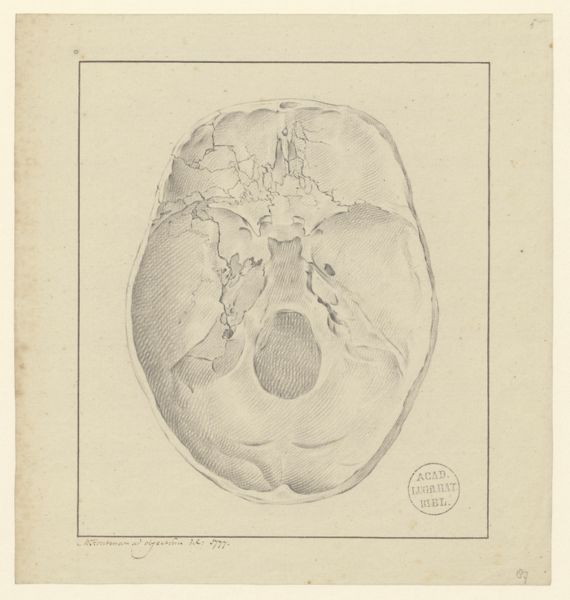 M Houtman, Pathology, fractures (Fractured skull)
