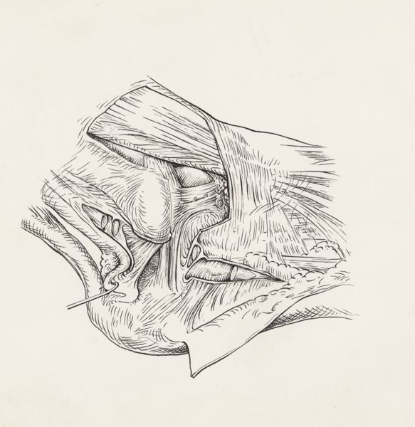 J Tinkelenberg, Muscular tissue of the foot