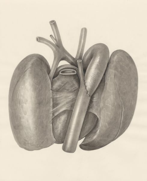 H.G Wetselaar, Surgical procedure on a heart and adjacent organs