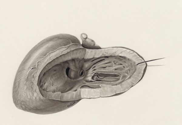H.G Wetselaar, Heart and adjacent organs
