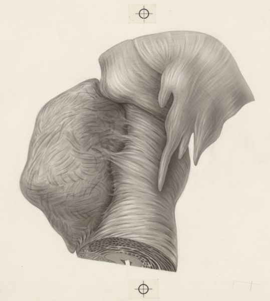 J Tinkelenberg, Human tissue