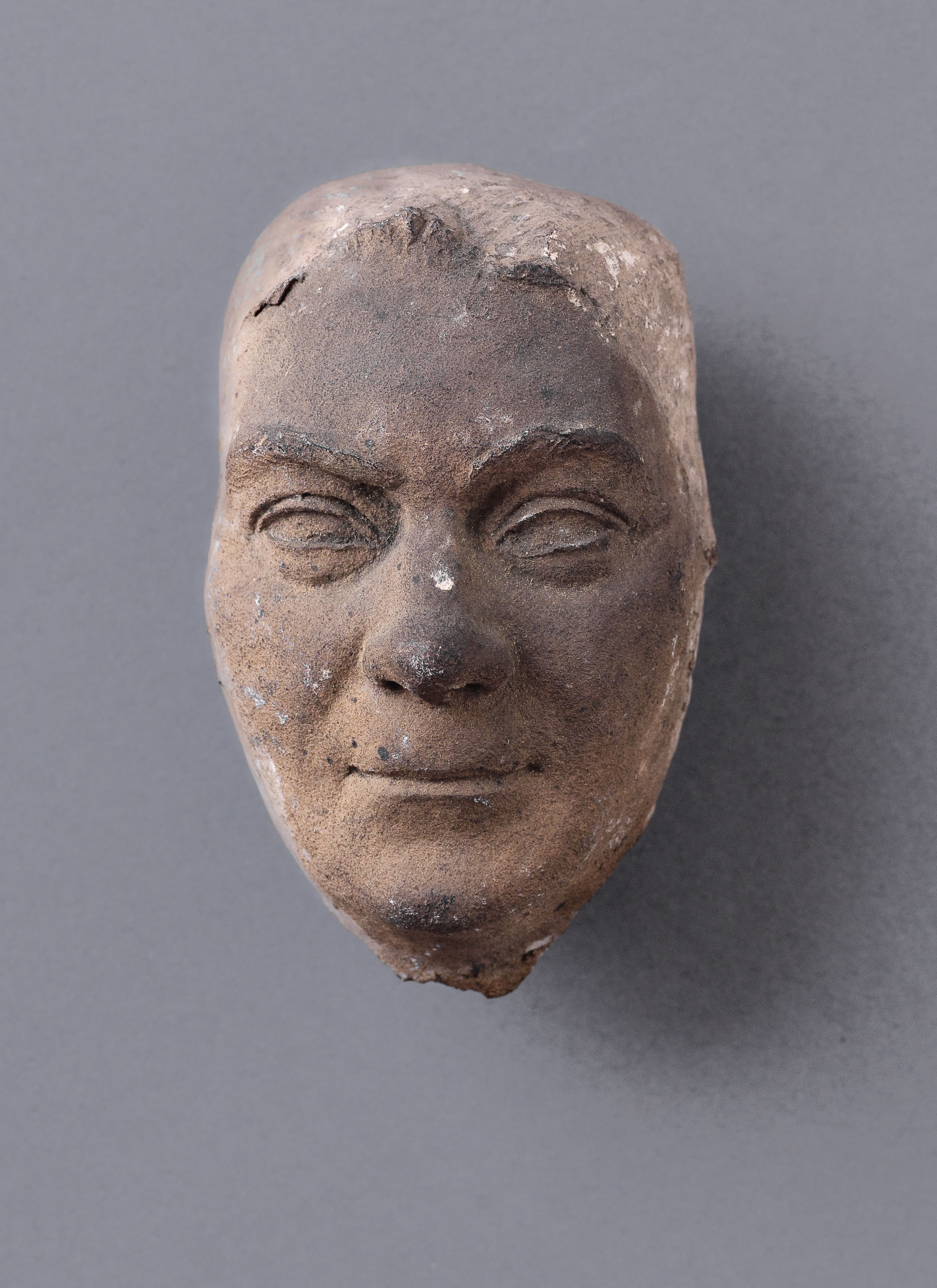 Jean Pierre Dantan, Portrait sérieux de Louis-Victor (?) Sterlin, médecin