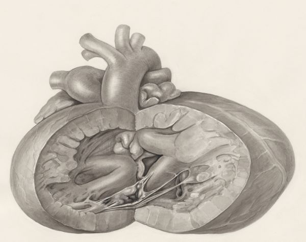H.G Wetselaar, Heart