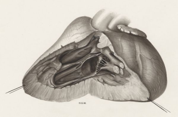 H.G Wetselaar, Heart