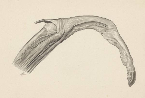 J Tinkelenberg, Musculoskeletal system of the upper extremity