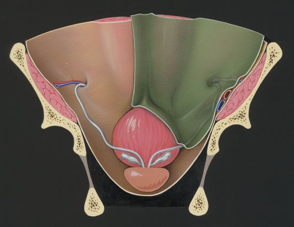 J Tinkelenberg, Prostate and adjacent tissue