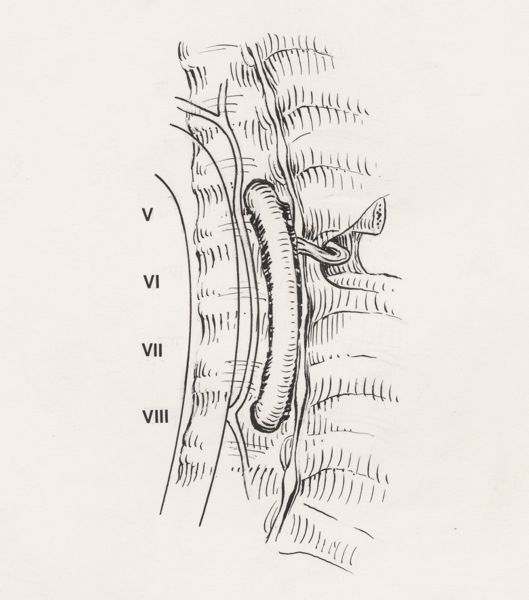 J Tinkelenberg, Orthopedic surgery