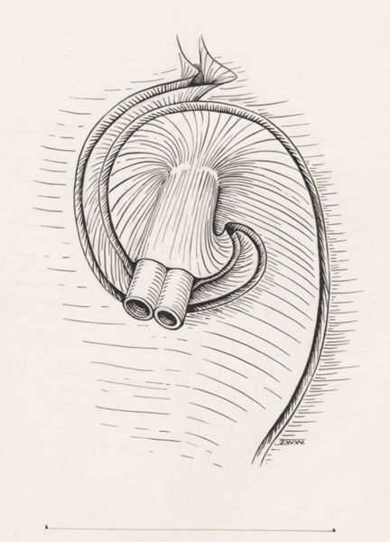 J Wetselaar-Whittaker, Intestinal tissue