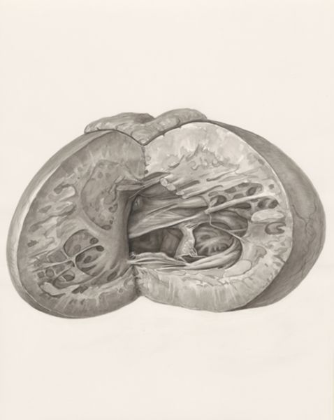 H.G Wetselaar, Heart