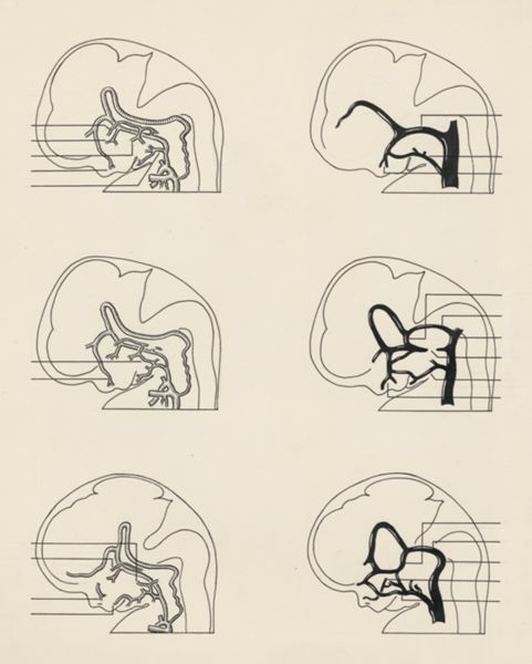 J Tinkelenberg, Cardiovascular system of an embryo