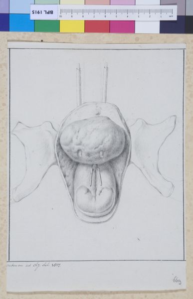M Houtman, Pubic area, scrotum