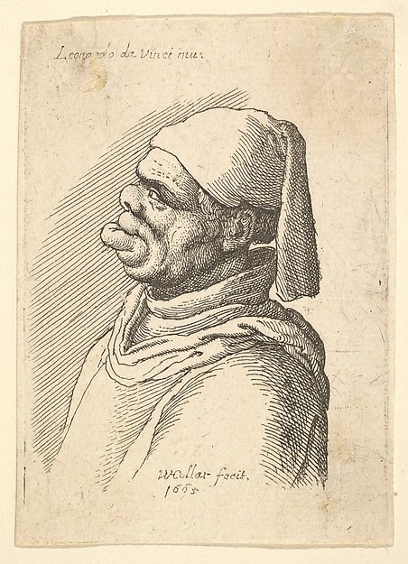 Wenceslaus Hollar, Bust of a deformed man with a hat and a fat, protruding lower lip in profile to left