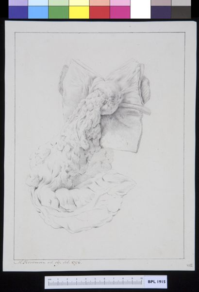 M Houtman, Inguinal hernia