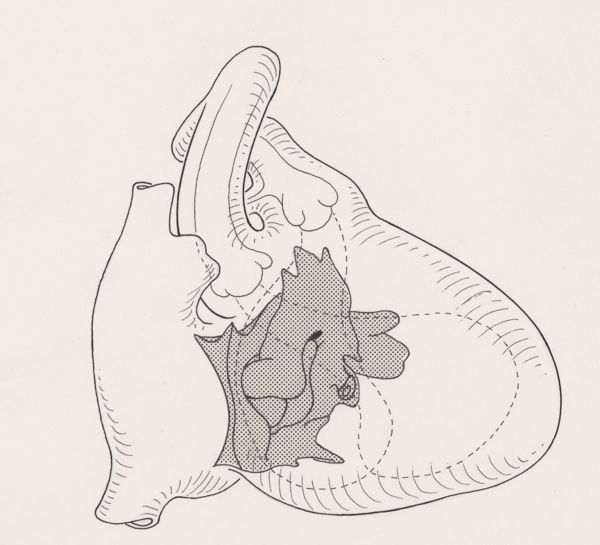 J Tinkelenberg, Schematic representation of the heart and circulatory system
