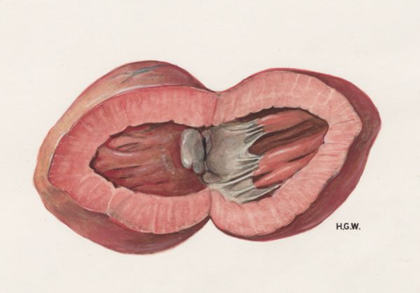 H.G Wetselaar, Heart and adjacent organs