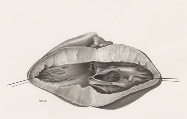 H.G Wetselaar, Heart and adjacent organs