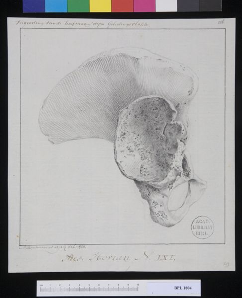 M. Houtman, Pathology, fractures (Acetabulum)
