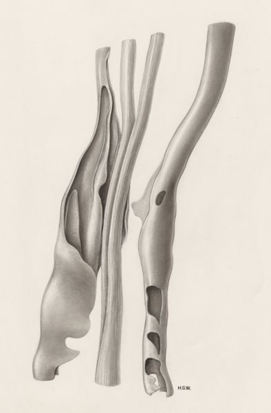 H.G Wetselaar, Musculoskeletal system of the hand