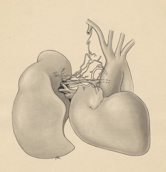 J Tinkelenberg, Part of the heart and circulatory system