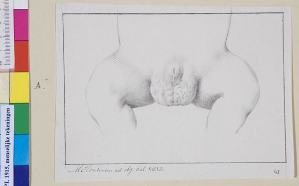 M Houtman, Genitals, hermaphrodite