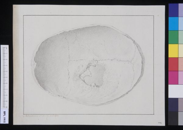 M Houtman, Calvaria (skull)