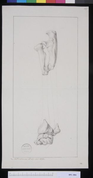 M. Houtman, Pathology, fractures (Forearm)