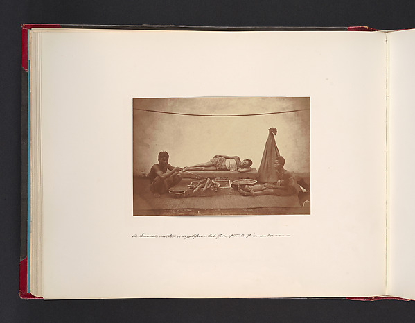 John Thomson, A Siamese Mother 15 Days Before a Hot Fire, After Confinement