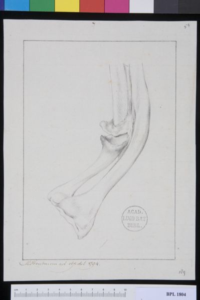 M. Houtman, Pathology, fractures (Forearm)