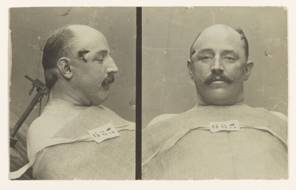 Alphonse Bertillon, [Two views of a man]