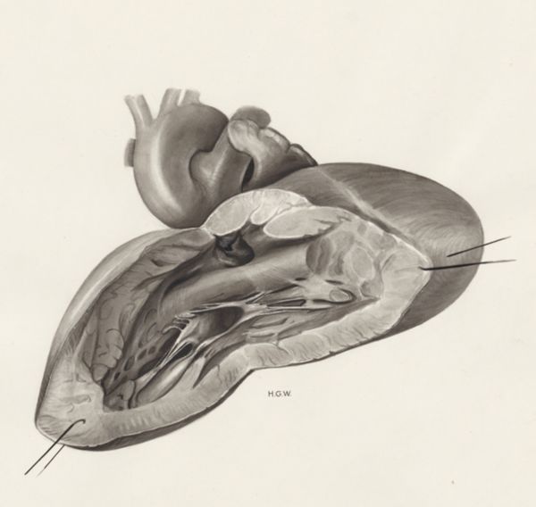 H.G Wetselaar, Heart and adjacent organs