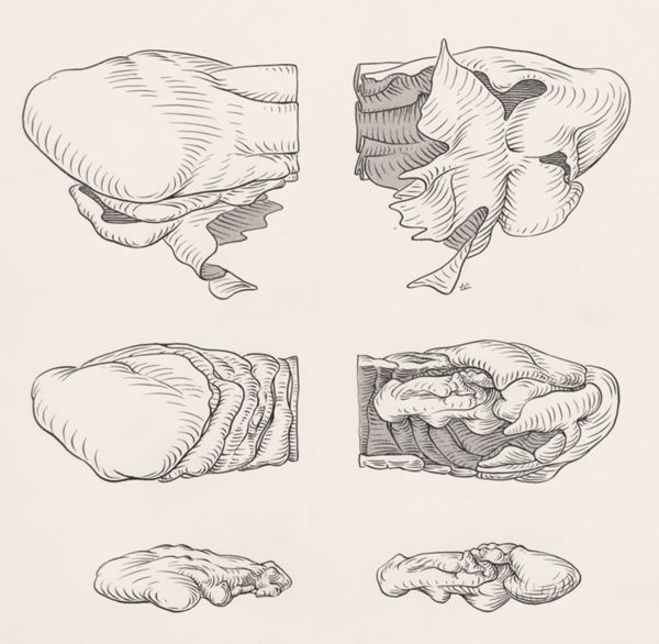 J Tinkelenberg, Reconstruction of the cerebellum