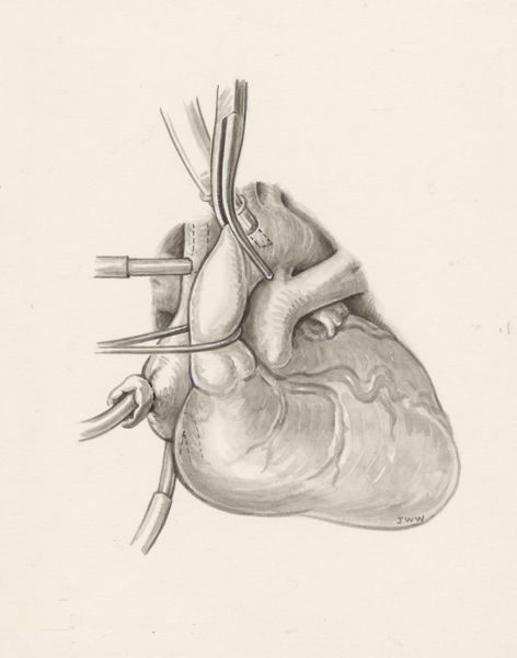 J Wetselaar-Whittaker, Cardiovascular system