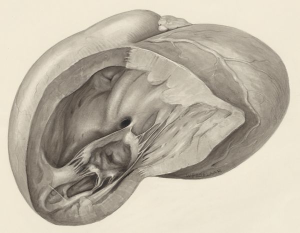H.G Wetselaar, Heart