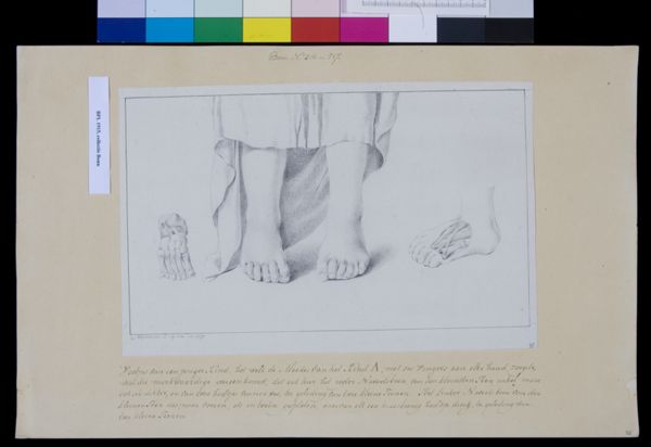 M. Houtman, Children's feet with six toes